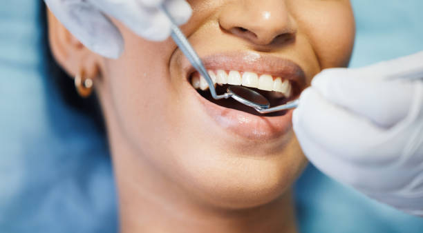 Best Emergency Tooth Extraction in Trinity, NC