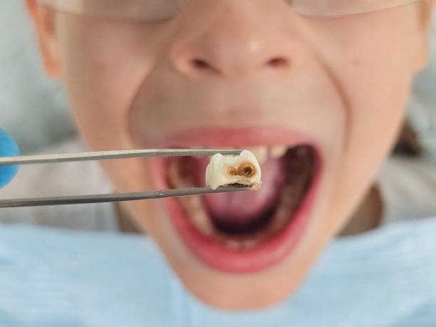 Best Emergency Treatment for Toothache in Trinity, NC